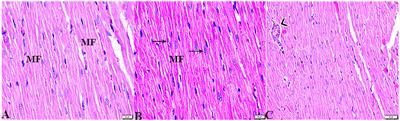 Melatonin ameliorates serobiochemical alterations and restores the cardio-nephro diabetic vascular and cellular alterations in streptozotocin-induced diabetic rats